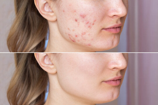 SKIN NATUROPATH CONSULT