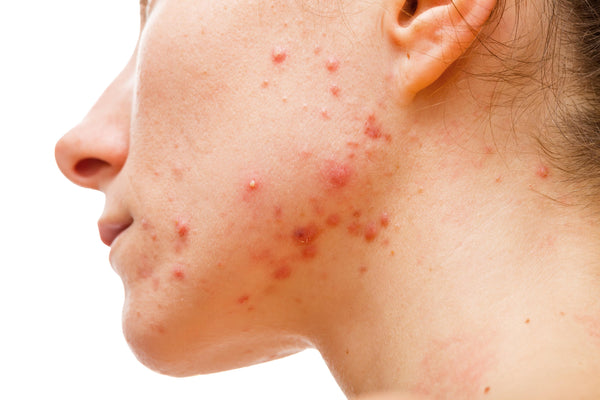 SKIN NATUROPATH CONSULT
